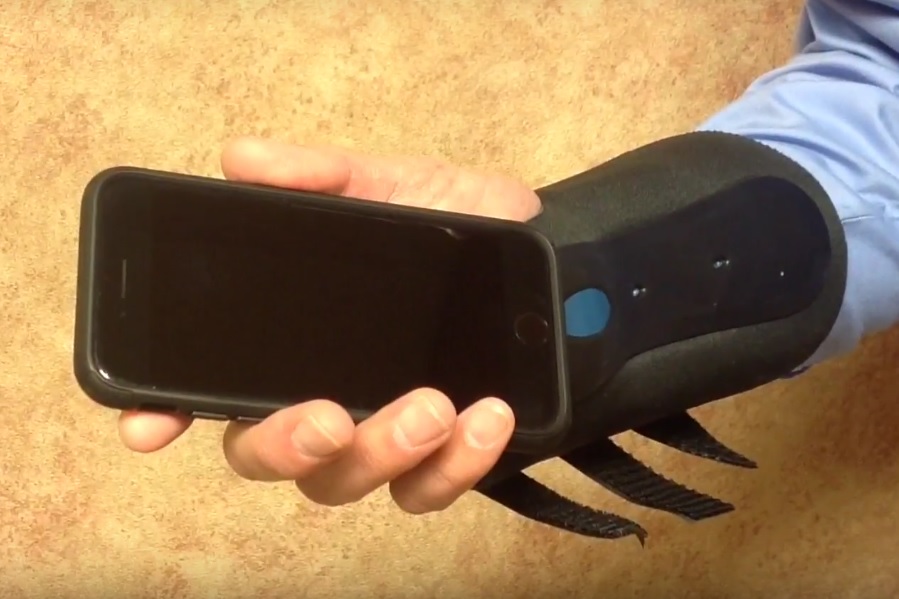 Carpal Tunnel Syndrome